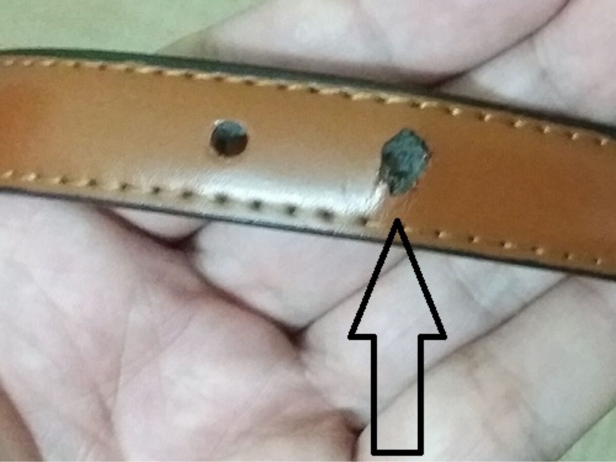 Lỗ thắt lưng bị giãn rộng do sử dụng quá chặt