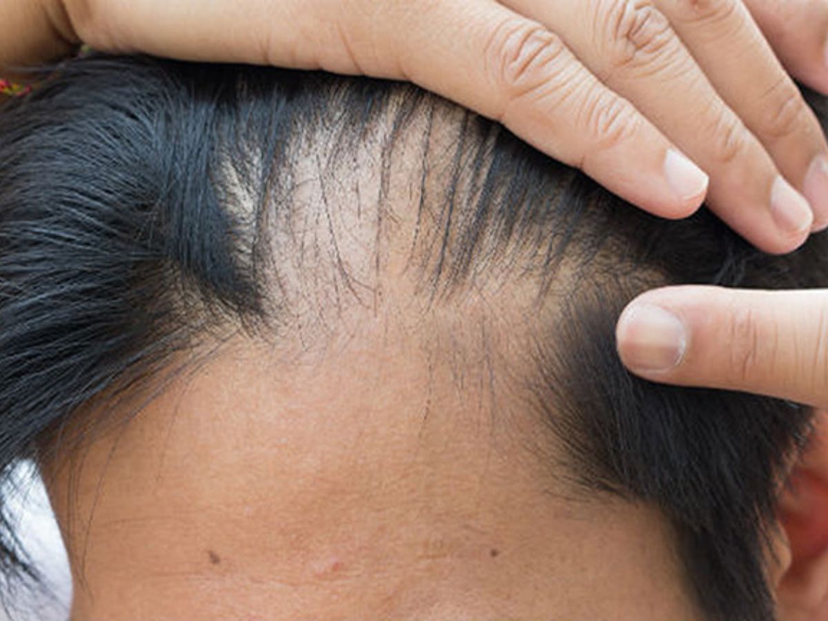  Khám phá hướng dẫn cách chăm sóc tóc cho nam từ A-Z