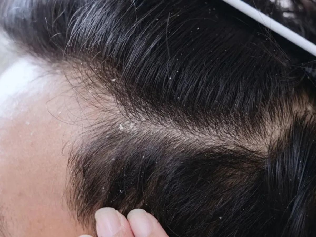  Khám phá hướng dẫn cách chăm sóc tóc cho nam từ A-Z