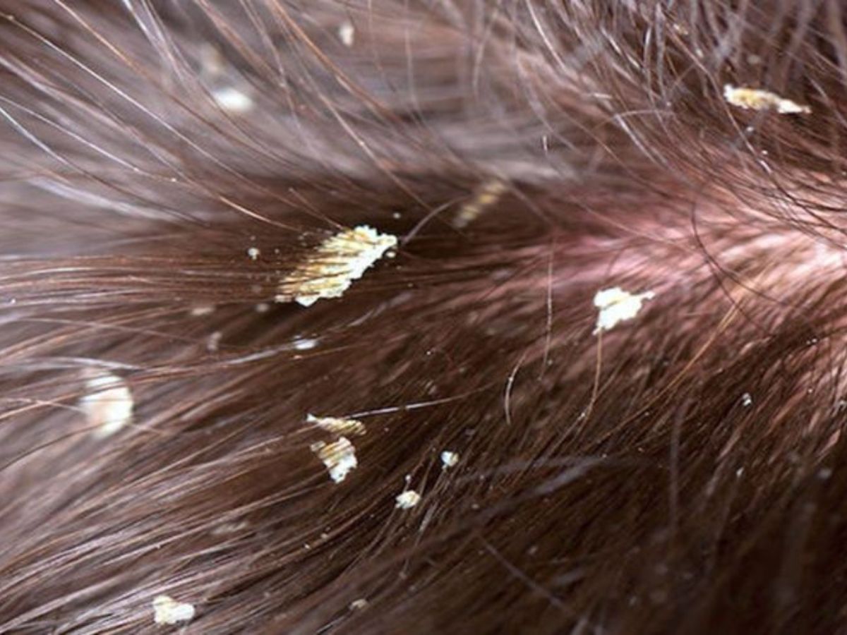  Khám phá hướng dẫn cách chăm sóc tóc cho nam từ A-Z