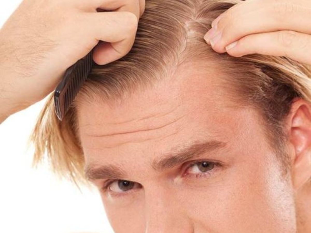  Khám phá hướng dẫn cách chăm sóc tóc cho nam từ A-Z