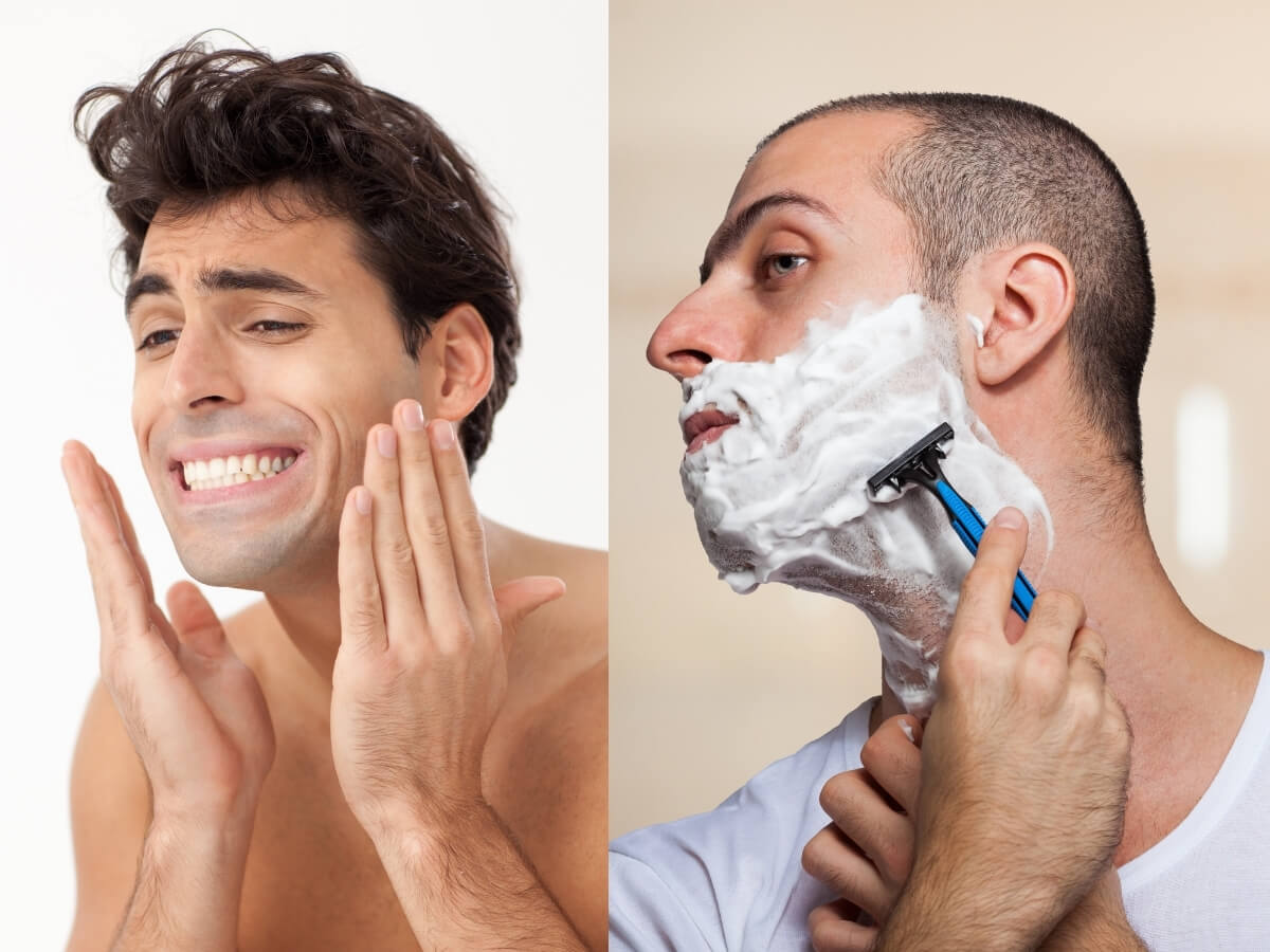 Vệ sinh và cạo râu sai cách dễ gây mụn ở nam giới