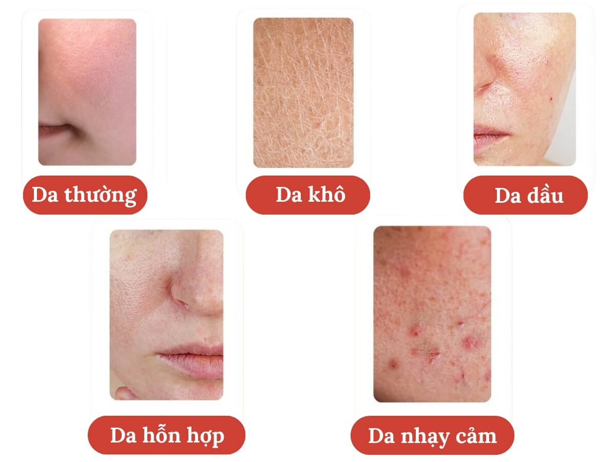 Các loại da ở nam giới