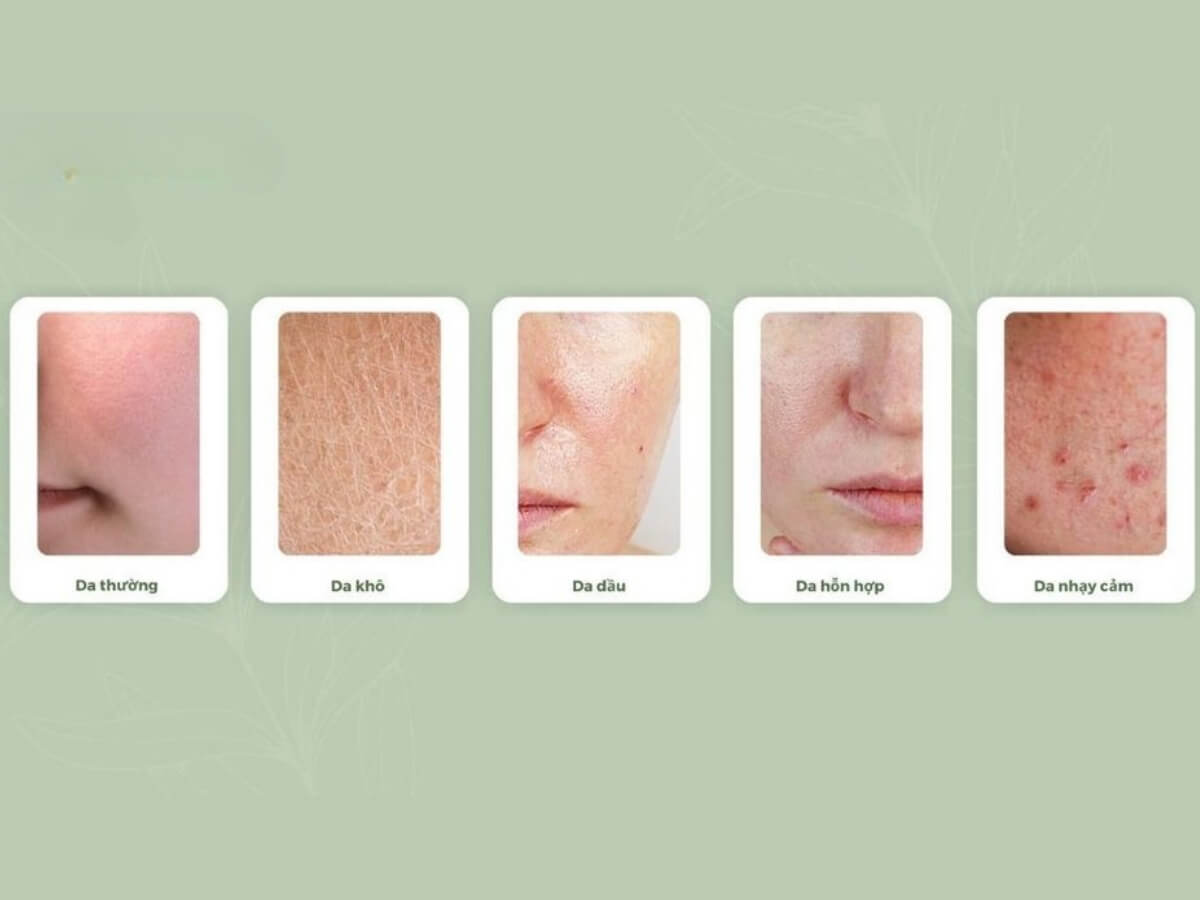 Phân biệt 5 loại da nam giới
