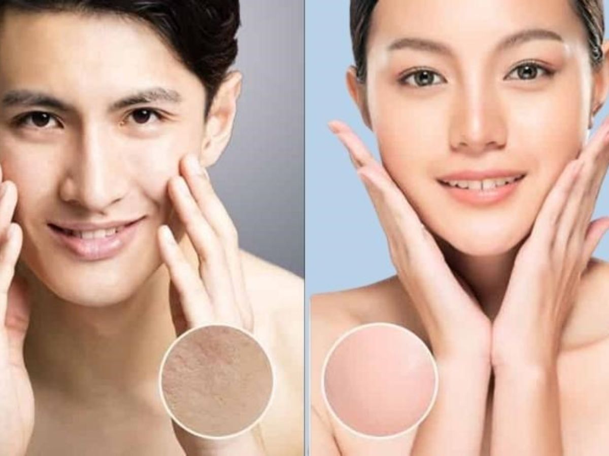Cấu trúc da nam tiết nhiều dầu hơn nữ giới khoảng 20%