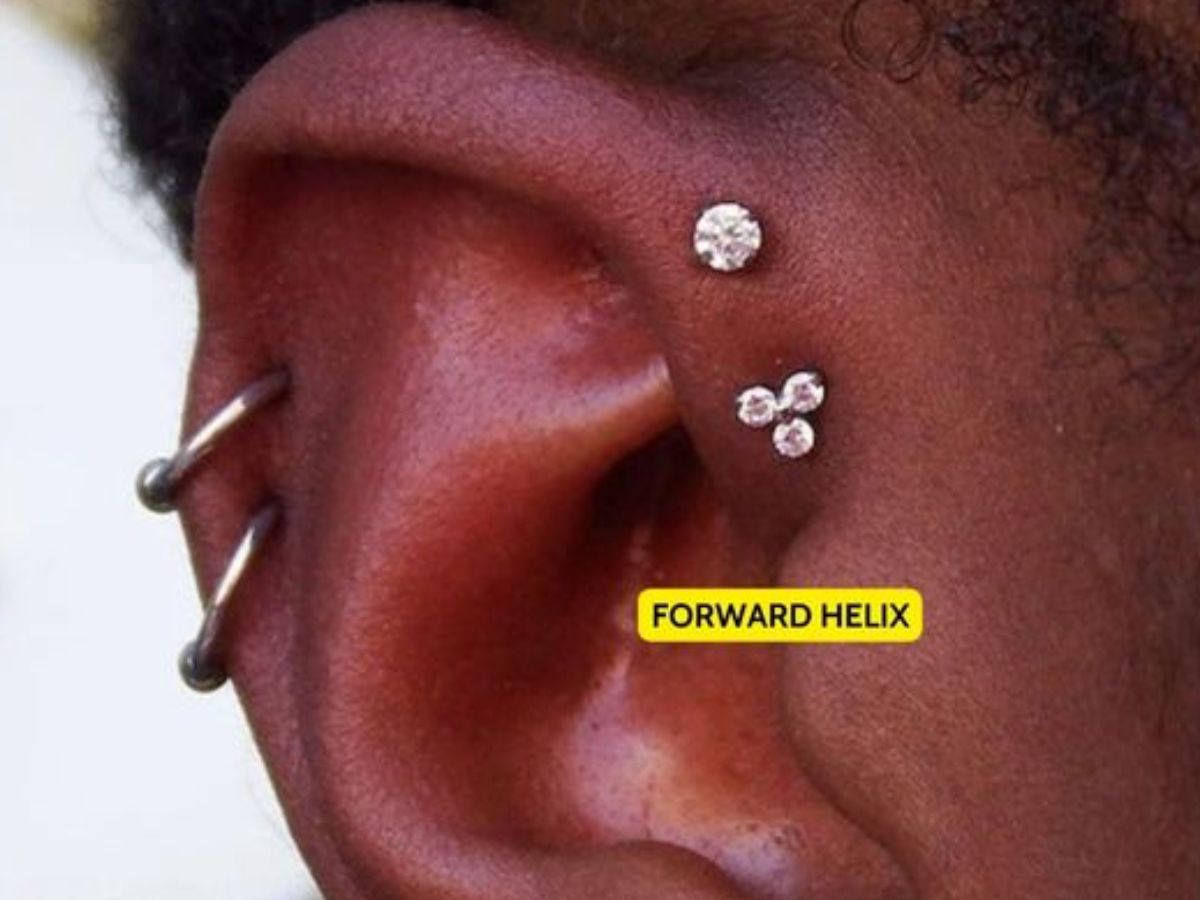 Forward Helix là vị trí nằm ở phần sụn ngay phía trước tai, gần thái dương