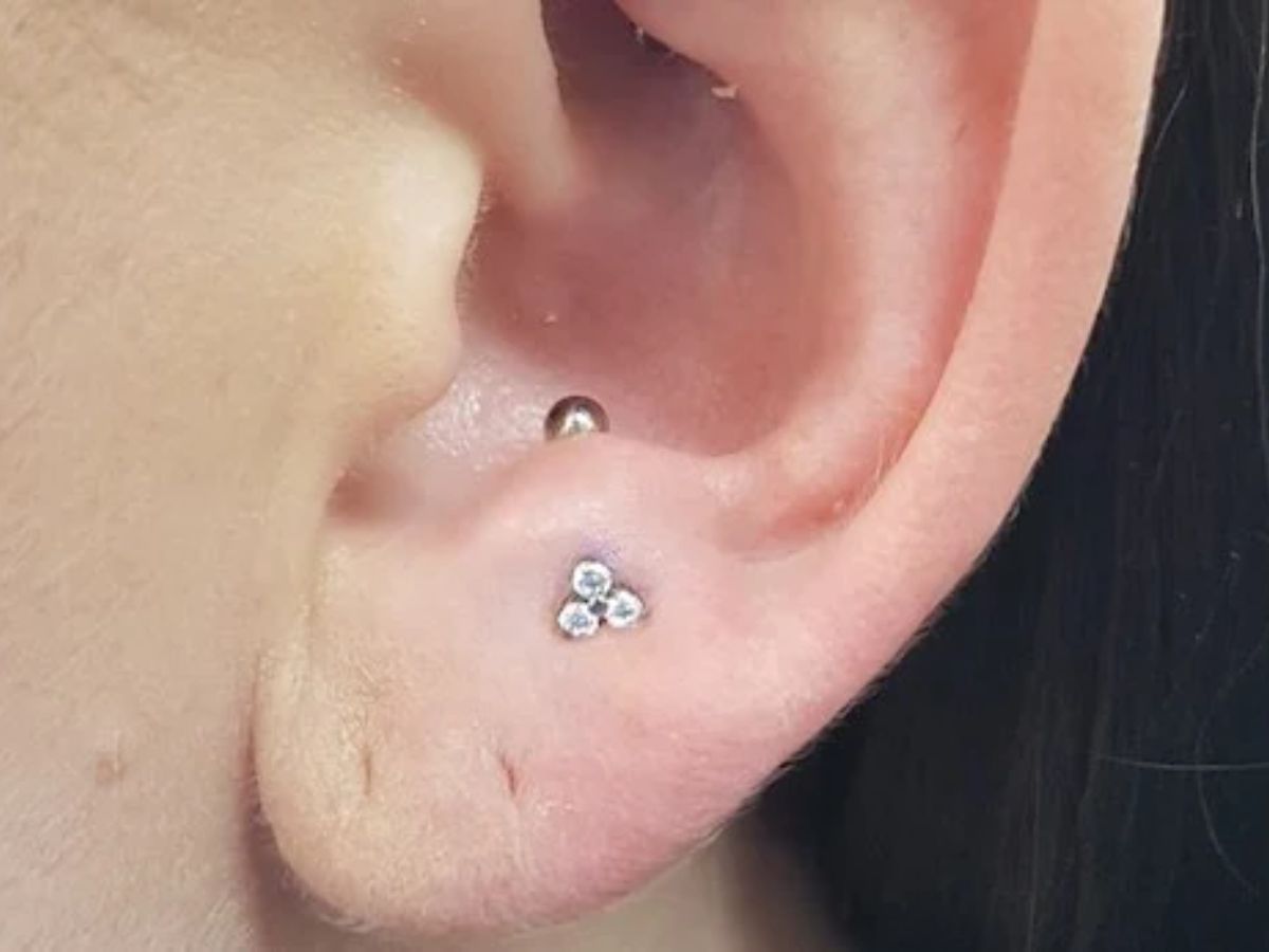Anti-Tragus là một vị trí khá hiếm gặp, nằm ở phần sụn đối diện với Tragus và ngay trên dái tai