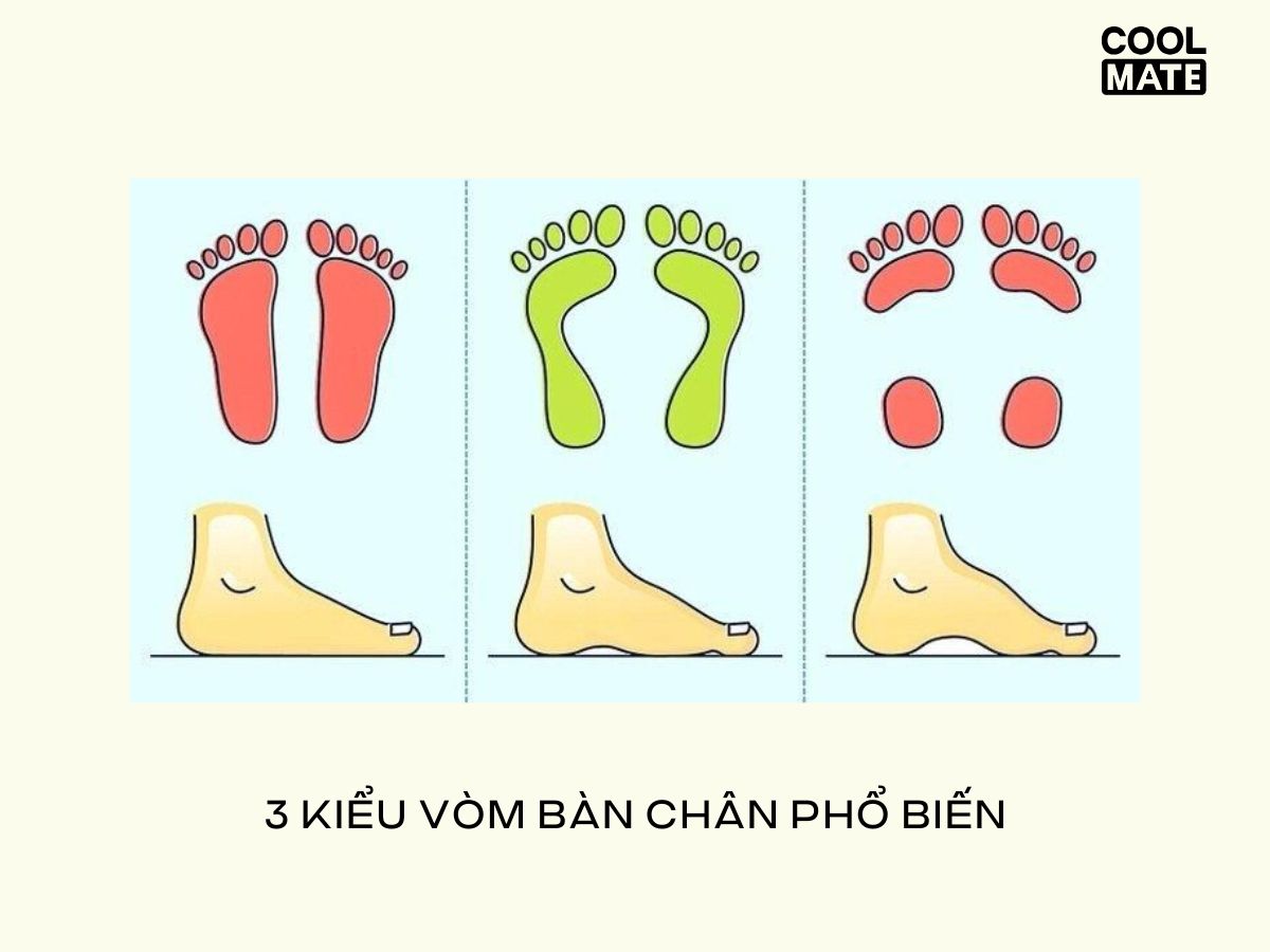 Tùy kiểu vòm bàn chân để chọn giày chạy phù hợp
