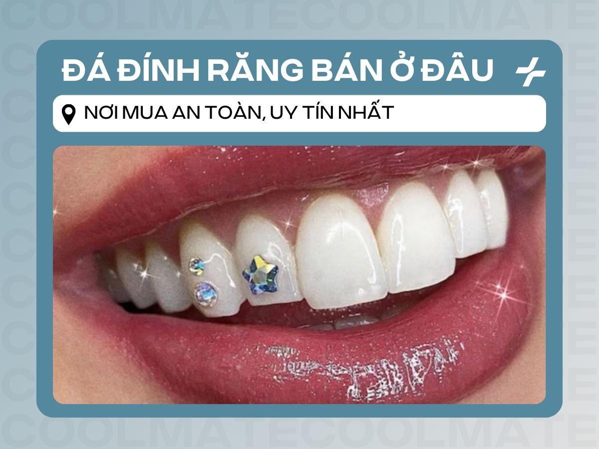Đá đính răng bán ở đâu? Tìm nơi mua uy tín, an toàn nhất