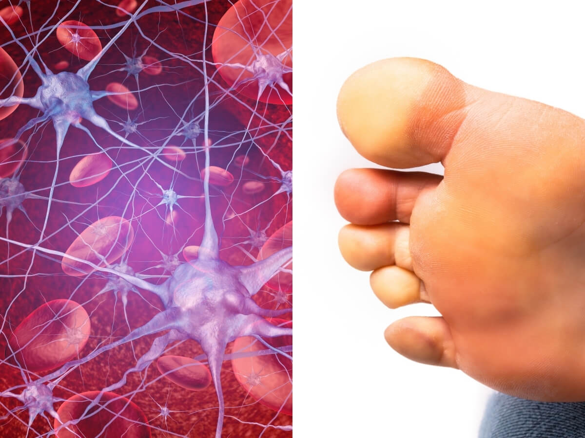 Đi tất khi đi ngủ cải thiện tuần hoàn, có lợi cho người lạnh đầu chi hoặc mắc Raynaud